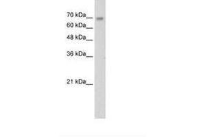 Image no. 1 for anti-Zinc Finger Protein 264 (ZNF264) (C-Term) antibody (ABIN6736283) (ZNF264 anticorps  (C-Term))