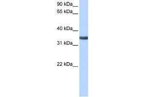 WB Suggested Anti-SPON2 Antibody Titration: 0.