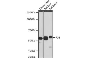 Western blot analysis of extracts of various cell lines, using FGB antibody (ABIN3021949, ABIN3021950, ABIN3021951 and ABIN6218213) at 1:1000 dilution. (Fibrinogen beta Chain anticorps  (AA 202-491))