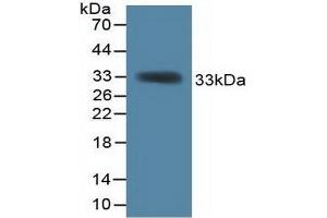 Detection of Recombinant KHDRBS1, Mouse using Polyclonal Antibody to KH Domain Containing, RNA Binding, Signal Transduction Associated Protein 1 (KHDRBS1) (KHDRBS1 anticorps  (AA 156-381))