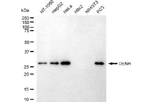 Western blotting analysis using DENR antibody (ABIN7798306).