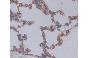 Used in DAB staining on fromalin fixed paraffin- embedded lung tissue (ABCA8 anticorps  (AA 1305-1516))