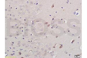 Formalin-fixed and paraffin embedded: rat brain tissue labeled with Anti-iNOS Polyclonal Antibody (ABIN725675) , Unconjugated at 1:200 followed by conjugation to the secondary antibody and DAB staining