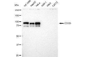 Western blotting analysis using CD105 antibody (ABIN7798440).