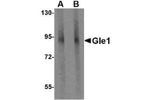 Western blot analysis of Gle1 in mouse brain tissue lysate with AP30366PU-N Gle1 antibody at (A) 1 and (B) 2 μg/ml.