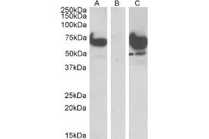 HEK293 lysate (10ug protein in RIPA buffer) overexpressing Human EPM2AIP1 with DYKDDDDK tag probed with ABIN5539635 (1ug/ml) in Lane A and probed with anti-DYKDDDDK Tag (1/1000) in lane C. (EPM2AIP1 anticorps  (N-Term))