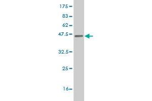 Western Blot detection against Immunogen (37. (ETV5 anticorps  (AA 181-290))