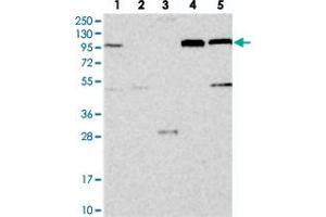 Western blot analysis of Lane 1: RT-4, Lane 2: U-251 MG, Lane 3: Human Plasma, Lane 4: Liver, Lane 5: Tonsil with COPB2 polyclonal antibody .