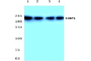 Western blot analysis of 53BP1 antibody at 1/500 dilution: Lane 1: Hela cell lysate. (TP53BP1 anticorps)