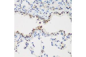 Immunohistochemistry of paraffin-embedded mouse lung using PCNA antibody. (PCNA anticorps  (AA 1-261))