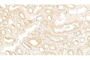 Detection of IGSF1 in Human Kidney Tissue using Polyclonal Antibody to Immunoglobulin superfamily, member 1 (IGSF1)