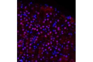 Immunofluorescence of paraffin embedded rat kidney using ZHX3 (ABIN7076287) at dilution of 1:650 (400x lens) (ZHX3 anticorps)