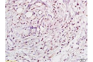 Formalin-fixed and paraffin embedded human gastric tissue labeled with Rabbit Anti-NFkB p105 / p50 Polyclonal Antibody, Unconjugated  at 1:200 followed by conjugation to the secondary antibody and DAB staining (NFKB1 anticorps  (AA 51-100))