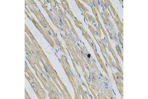 Immunohistochemistry of paraffin-embedded rat heart using PRNP Antibody (ABIN5971407) at dilution of 1/100 (40x lens). (PRNP anticorps)