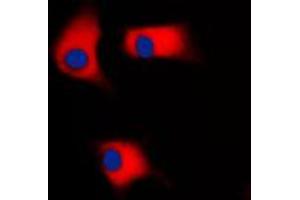 Immunofluorescent analysis of CK1 gamma 2 staining in Raw264.