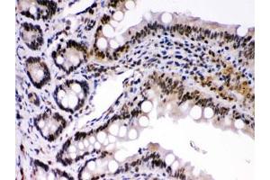 IHC testing of mouse intestine with c-Rel antibody. (c-Rel anticorps)
