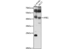 Western blot analysis of extracts of various cell lines, using AREG antibody (ABIN6127431, ABIN6137065, ABIN6137066 and ABIN6216408) at 1:1000 dilution. (Amphiregulin anticorps  (AA 20-252))