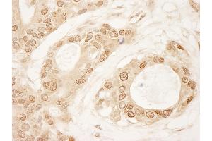 Immunohistochemistry (IHC) image for anti-Chromosome 1 Open Reading Frame 55 (C1orf55) (AA 350-400) antibody (ABIN7448452) (C1orf55 anticorps  (AA 350-400))