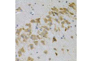 Immunohistochemistry of paraffin-embedded mouse brain using IGFBP4 Antibody.