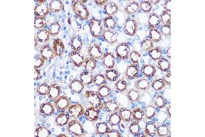 Immunohistochemistry of paraffin-embedded mouse kidney using BMP7 Rabbit pAb (ABIN3021108, ABIN3021109, ABIN3021110 and ABIN6213955) at dilution of 1:100 (40x lens).