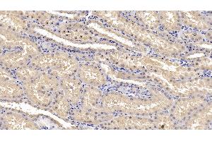 Detection of IL1RA in Human Kidney Tissue using Monoclonal Antibody to Interleukin 1 Receptor Antagonist (IL1RA)