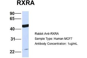 Host:  Rabbit  Target Name:  RXRA  Sample Type:  Human MCF7  Antibody Dilution:  1. (Retinoid X Receptor alpha anticorps  (N-Term))