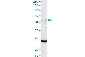 GALNT12 MaxPab rabbit polyclonal antibody.