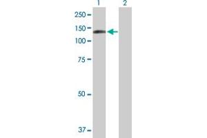 Western Blot analysis of DDX24 expression in transfected 293T cell line by DDX24 MaxPab polyclonal antibody.