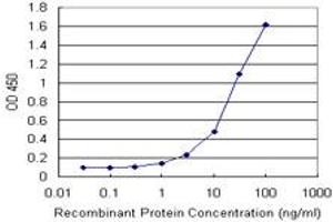 Detection limit for recombinant GST tagged FTL is 1 ng/ml as a capture antibody. (FTL anticorps)