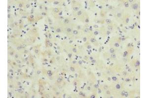 Immunohistochemistry of paraffin-embedded human liver tissue using ABIN7153138 at dilution of 1:100