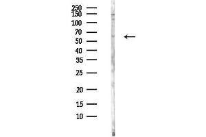 anti-Cholinergic Receptor, Nicotinic, delta (Muscle) (CHRND) antibody