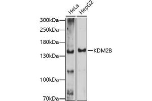 Western blot analysis of extracts of various cell lines, using KDM2B antibody (ABIN7268327) at 1:1000 dilution. (KDM2B anticorps  (AA 600-700))