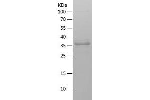 Western Blotting (WB) image for Phosphoinositide-3-Kinase, Catalytic, beta Polypeptide (PIK3CB) (AA 131-257) protein (His-IF2DI Tag) (ABIN7124426)