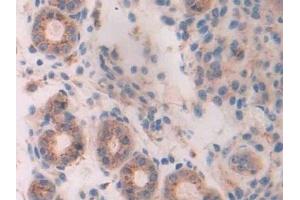 Detection of TPP1 in Mouse Uterus Tissue using Polyclonal Antibody to Tripeptidyl Peptidase I (TPP1)