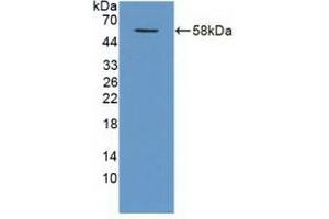 Detection of Recombinant TRAF1, Human using Polyclonal Antibody to TNF Receptor Associated Factor 1 (TRAF1) (TRAF1 anticorps  (AA 131-381))