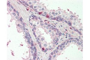 Anti-MCUR1 / CCDC90A antibody IHC staining of human prostate.