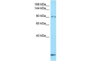 WB Suggested Anti-Fbxo11 Antibody   Titration: 1. (FBXO11 anticorps  (C-Term))