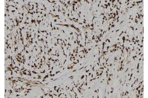 ABIN6273180 at 1/100 staining Human gastric tissue by IHC-P. (TARBP2 anticorps  (Internal Region))