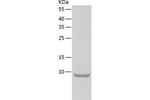 Western Blotting (WB) image for Prokineticin 1 (Prok1) (AA 20-105) protein (His tag) (ABIN7124580)