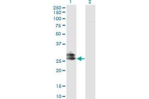 Western Blot analysis of EPDR1 expression in transfected 293T cell line by EPDR1 monoclonal antibody (M01), clone 1C1.