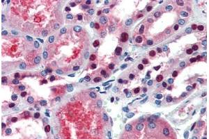 Human Kidney (formalin-fixed, paraffin-embedded) stained with PAX7 antibody ABIN462176 followed by biotinylated goat anti-rabbit IgG secondary antibody ABIN481713, alkaline phosphatase-streptavidin and chromogen.