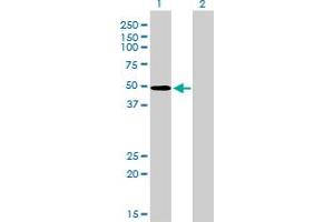 Western Blot analysis of ZNF207 expression in transfected 293T cell line by ZNF207 monoclonal antibody (M09), clone 1A2.