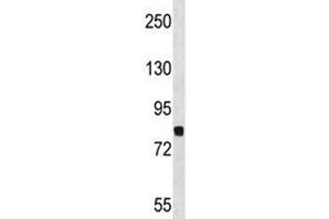 Dyrk1a antibody western blot analysis in NCI-H460 lysate.