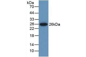 Detection of Recombinant MUSK, Mouse using Polyclonal Antibody to Muscle, Skeletal, Receptor Tyrosine Kinase (MUSK)