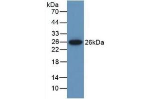 Detection of Recombinant MUSK, Mouse using Polyclonal Antibody to Muscle, Skeletal, Receptor Tyrosine Kinase (MUSK) (MUSK anticorps  (AA 517-777))