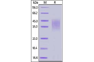 Biotinylated Mouse CD47, His,Avitag on  under reducing (R) condition.