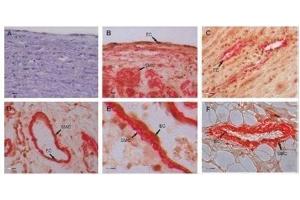 Image kindly submitted by Dr. (GREM1 anticorps  (AA 101-184))