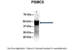 Amount and Sample Type :  500 ug mouse brain homogenate  Amount of IP Antibody :  6 ug  Primary Antibody :  PSMC5  Primary Antibody Dilution :  1:500  Secondary Antibody :  Goat anti-rabbit Alexa-Fluor 594  Secondary Antibody Dilution :  1:5000  Gene Name :  PSMC5  Submitted by :  Dr. (PSMC5 anticorps  (C-Term))