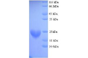 SDS-PAGE (SDS) image for Centromere Protein A (CENPA) (AA 1-134), (full length) protein (His tag) (ABIN5713352)