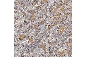 IHC analysis of EIF2AK1 using anti-EIF2AK1 antibody (ABIN7601508). (EIF2AK1 anticorps  (AA 37-508))